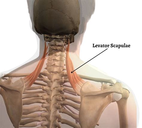 Neck Pain and Levator Scapulae Syndrome