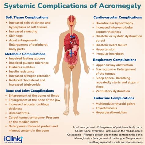 Acromegaly Tongue