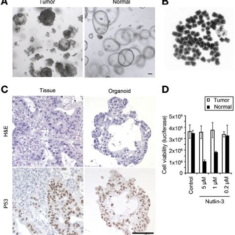 Single stem cells from human gastric mucosa can form gastric organoids ...