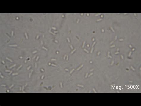 [最も好ましい] e coli under microscope 10x 148061-What does e coli look like ...