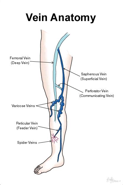 Acute embolism and thrombosis deep veins lower extremity