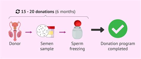 How is sperm donation explained step by step?