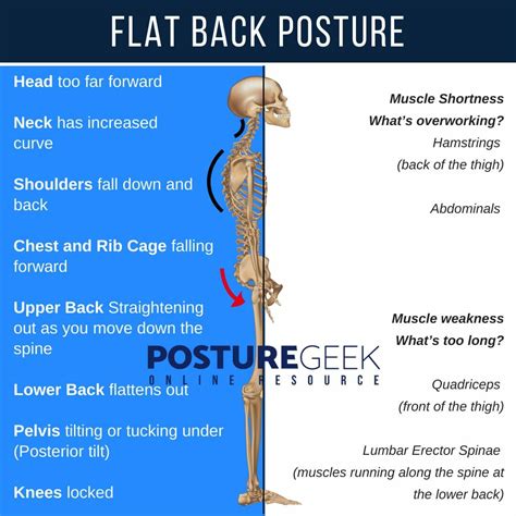 How To Know You Have Flat Back Posture | PostureGeek.com