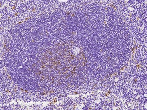 CD8 alpha Antibody (PA5-81344)