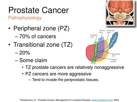 Prostate Cancer Pathophysiology