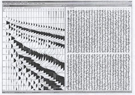 Seismic Data Seismogram for the reflection seismic survey [31] | Download Scientific Diagram