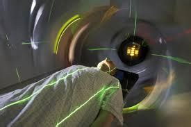 Radiotherapy side effects-Top 5 side effects of radiotherapy.