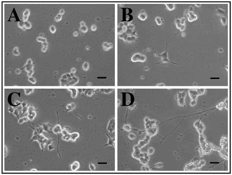 Differentiation of PC-12 cells attached to culture dishes coated with... | Download Scientific ...