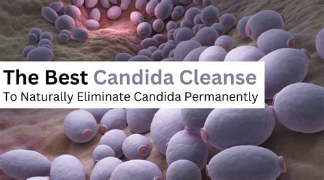 #1 Candida Cleanse To Permanently Get Rid Of Candida