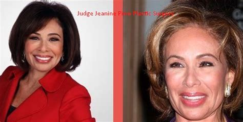 UPDATED! Judge Jeanine Pirro Plastic Surgery Before After 2022