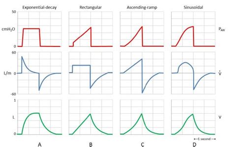Ventilator Waveforms