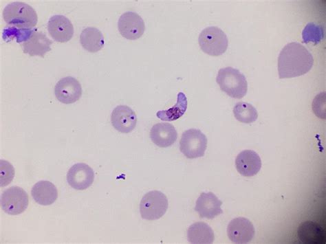 Plasmodium falciparum: qué es, características, ciclo de vida, síntomas