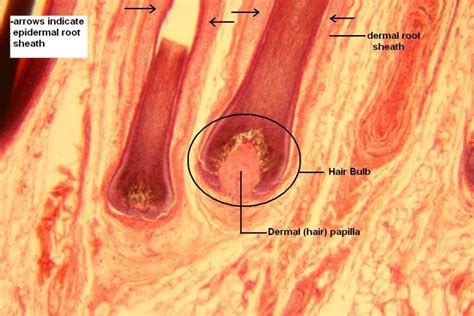 Skin of Scalp – Tutorial – Histology Atlas for Anatomy and Physiology