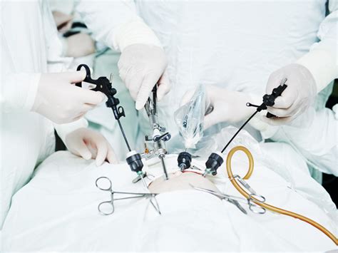 Laparoscopy: Purpose, Preparation, Procedure, and Recovery