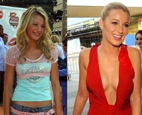 Blake Lively before and after