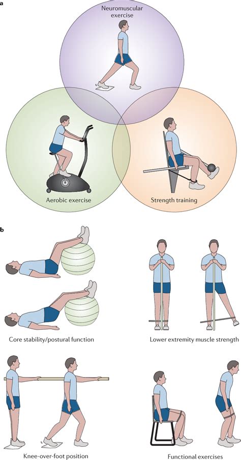 [PDF] Strategies for the prevention of knee osteoarthritis | Semantic ...