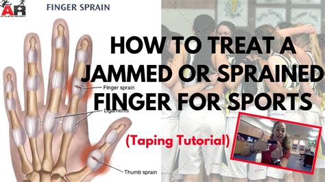 How To Treat a Jammed or Sprained Finger For Sports - YouTube