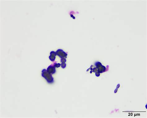 Urine crystals | eClinpath