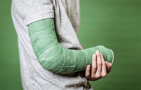 Cast & Splint Care | Illinois Bone & Joint Institute