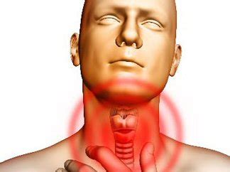 Sore Throat Types Symptoms Treatment and Home Remedies ...