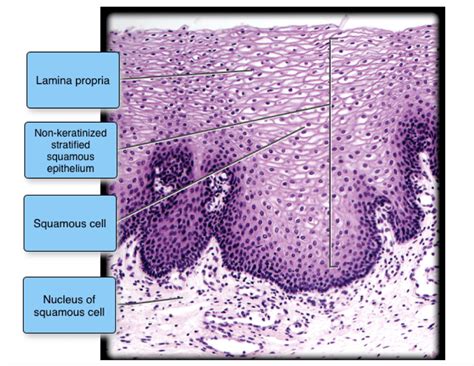 Keratinized Vs Non Keratinized Stratified Squamous Epithelium ...