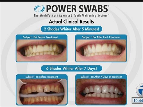 Power Swabs Teeth Whitening - WKBW.com Buffalo, NY