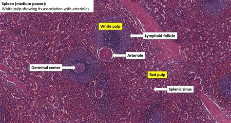 Spleen – Normal Histology – NUS Pathweb :: NUS Pathweb