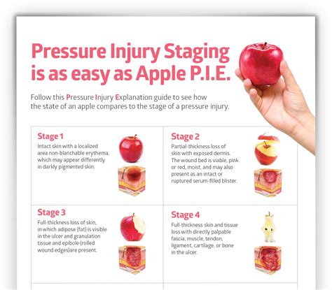 Pressure Injury Staging Guide Pressure Ulcer Staging Pressure Ulcer - Bank2home.com