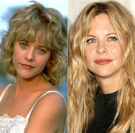 Meg Ryan Before And After Photos