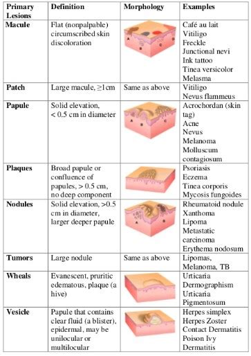 Nodule Skin Lesion