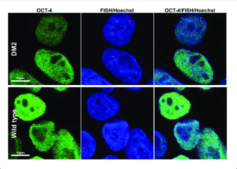 | RNA-FISH in hiPSCs. Representative confocal microscopic images ...