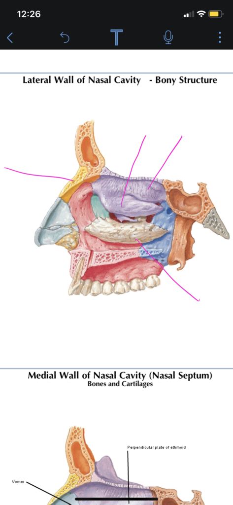 A&P Lateral wall of Nasal Cavity Diagram | Quizlet