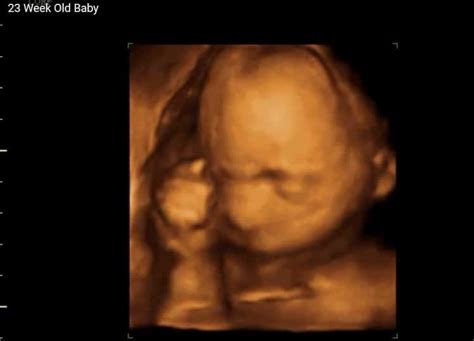 3D 4D Ultrasound at 23 Weeks Video - View A Miracle 4D Ultrasounds