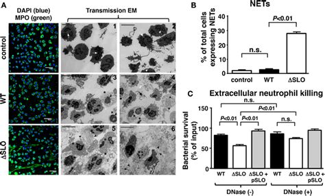 Streptolysin O inhibits NET formation and extracellular killing. (A)... | Download Scientific ...