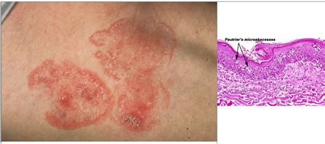 Pin on Dermatology Preparation