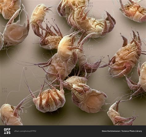 Color scanning electron micrograph of house dust mites (Dermatophagoides pteronyssinus). stock ...