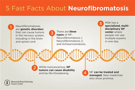 Neurofibromatosis | Memorial Sloan Kettering Cancer Center