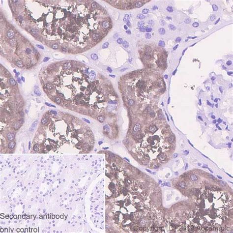 Recombinant Anti-Aldolase B + Aldolase C antibody [EPR3138Y] (ab75751 ...