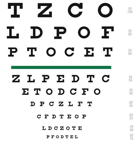 ONLINE Tools for Vision Screening – Edsel Ing: Eyelid Strabismus Orbit Neuro Ophthalmology