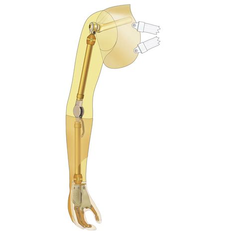 Passive arm prostheses | Ottobock US