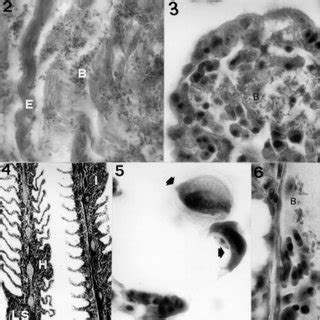 (PDF) Vibrio alginolyticus infection in cobia (Rachycentron canadum) cultured in Taiwan