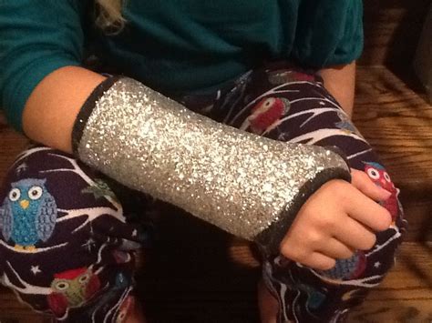 Sparkle up Your Arm Cast with Glitter and Modge Podge