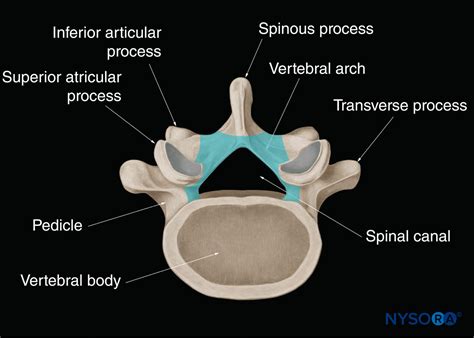 Spinal Sonography and Applications of Ultrasound for Central Neuraxial ...