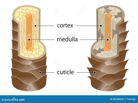 Damaged Cuticle Layer Cause Damaged Hair Cartoon Vector | CartoonDealer.com #68333967