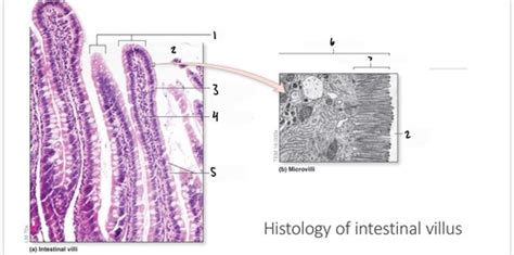 histology of intestinal villus Flashcards | Quizlet