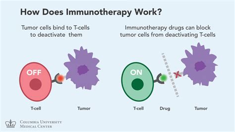 Immunotherapy: New Hope for Patients with Advanced Lung Cancer | Columbia University Irving ...