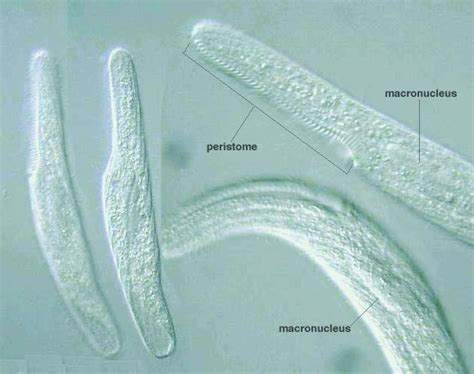 Spirostomum Under Microscope 400X