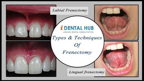 Pin by W Bowman, RDA, CDA on Smiles and Toofers | Pinterest