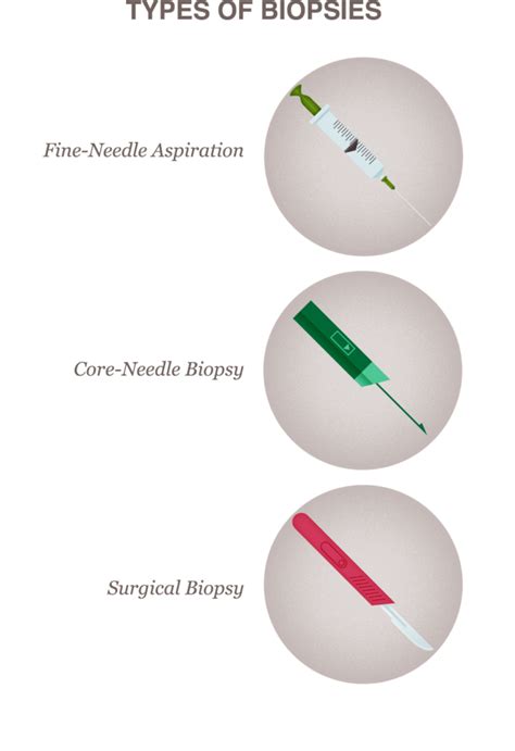 Breast Biopsy: Procedure Types, What to Expect & Results Guide