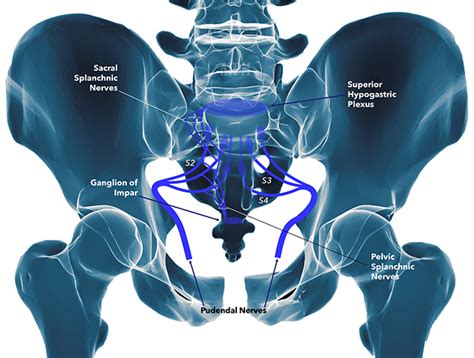 Pudendal Nerve Entrapment | Modern Care Clinic